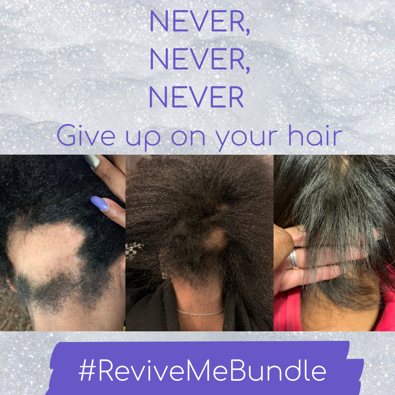 Never Give Up On Your Hair!